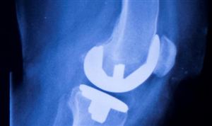 2023年CT设备市场投资前景分析