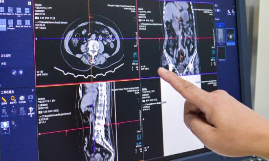 我国医学影像设备行业市场分析2024
