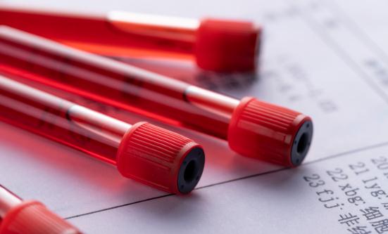 2024血液制品产业发展现状及市场供需格局分析