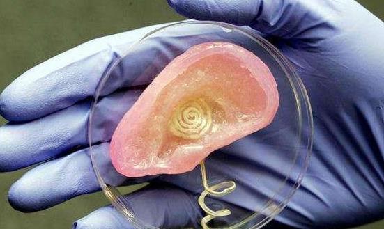 人工器官行业投资价值：到2029年市场规模有望达到4475.32亿元人民币